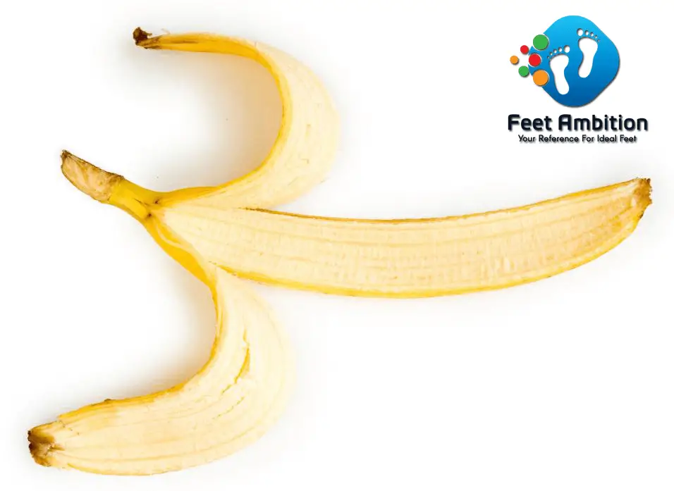 Banana Peels1 Banana Peels1