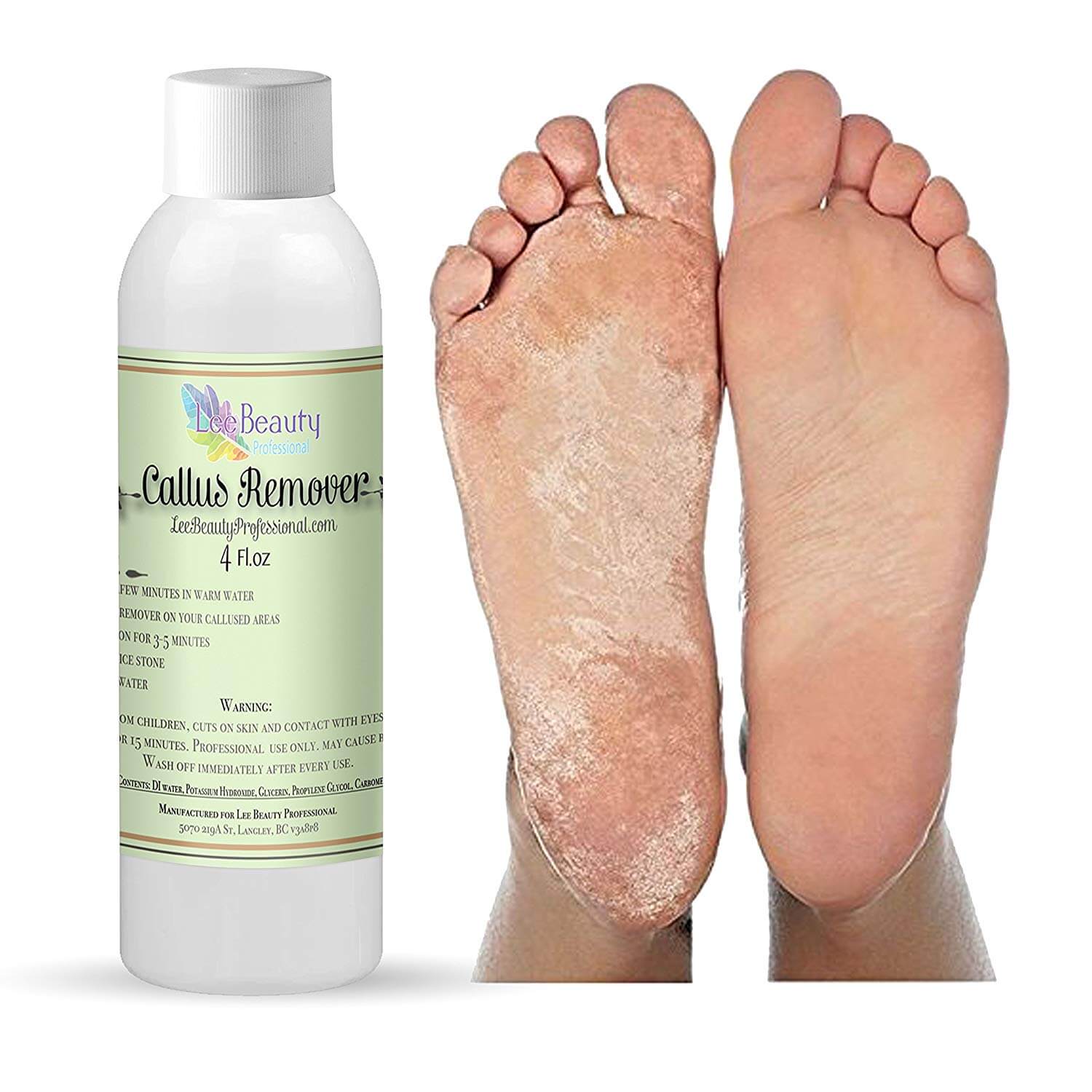Callus Eliminator,Liquid & Gel Callus Eliminator,Liquid & Gel