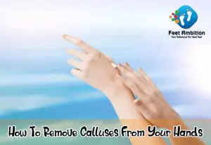 How To Remove Calluses From Your Hands