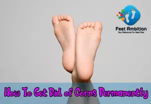 How To Get Rid of Corns Permanently