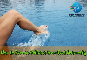 How to Remove Calluses From Feet Naturally