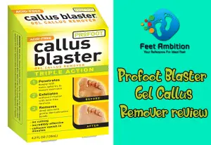 Profoot Blaster Gel Callus Remover review