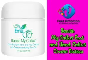 Banish My Callus Foot and Hand Callus Cream Review