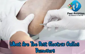 What Are The Best Electric Callus Removers